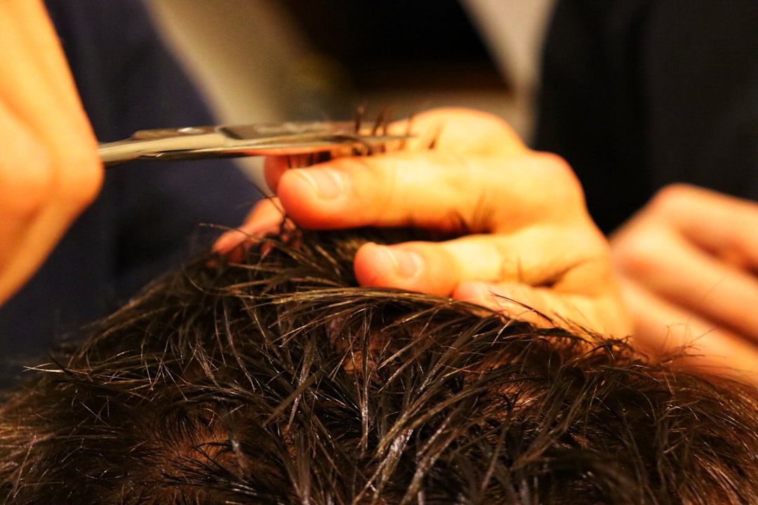 Photo Hair transplant